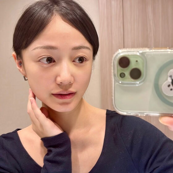 【美容医療】ハリツヤに効果あり？リジュラン注射の術後レポ【sweet lovers】