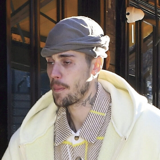 疲労困憊？ジャスティン・ビーバーの激変した近影など【海外セレブの気になるゴシップ情報】