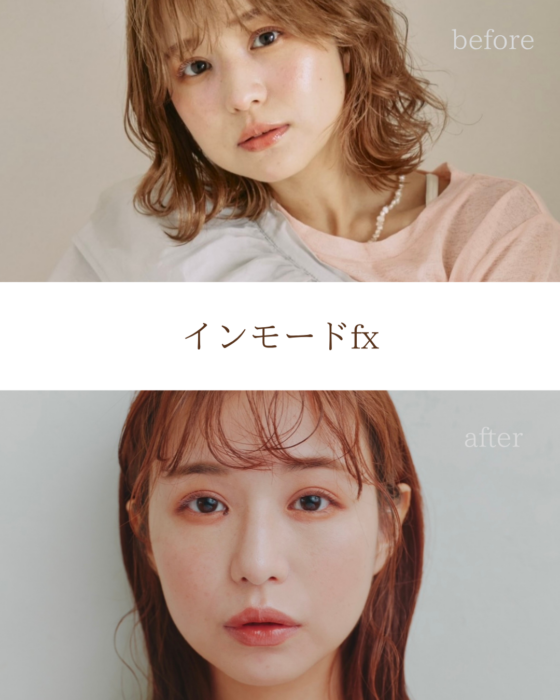 【美容医療】実際にやってよかった！効果を実感できた韓国の美容施術レポ【sweet lovers】