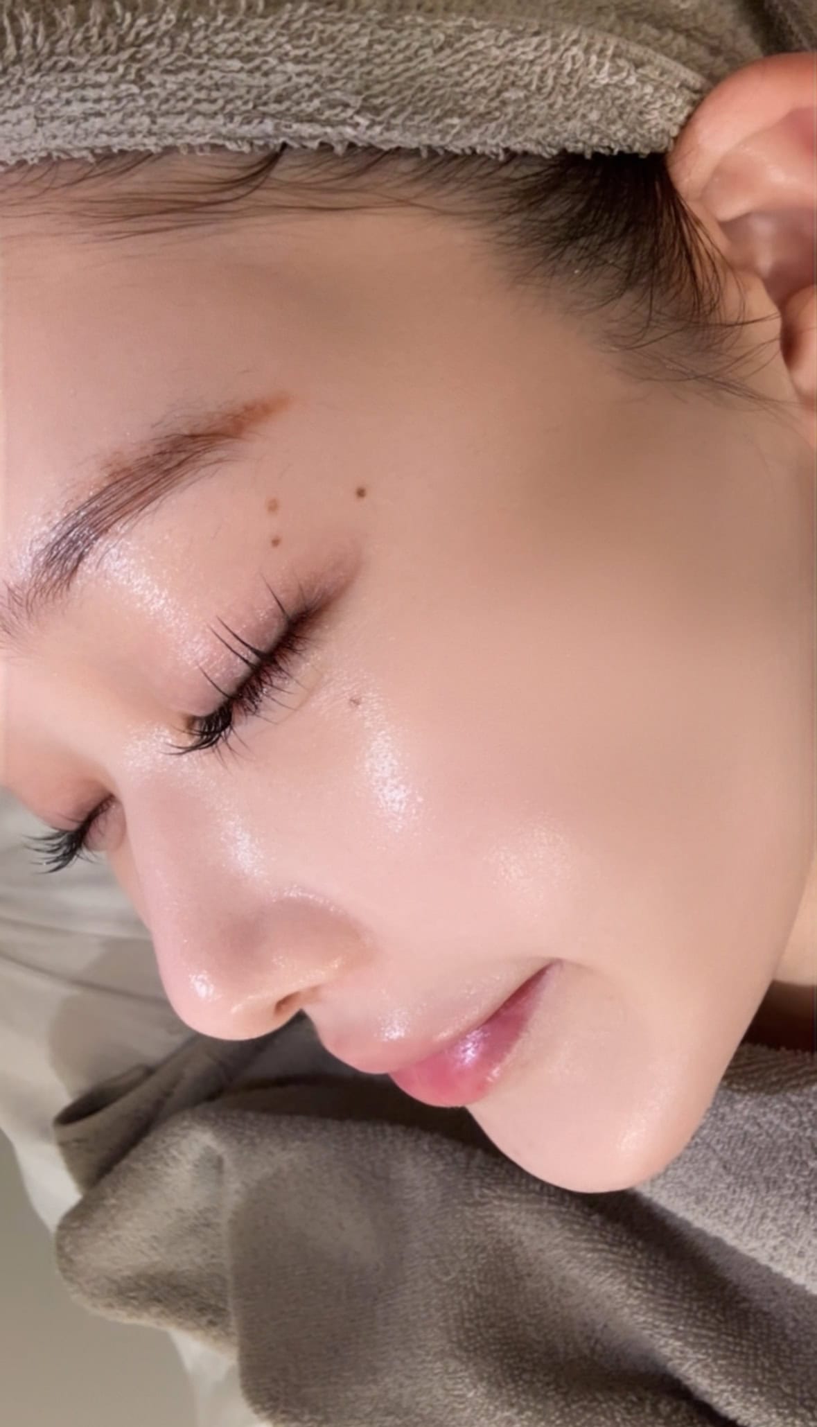 ツヤ美肌の作り方：肌管理はクリニックへ