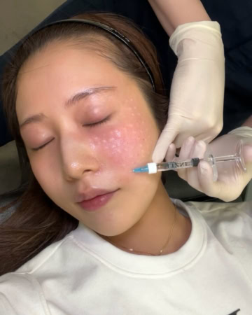 【美容アプデ】「もっと早くやればよかった！」肌治療からバストケアまで、満足度が高すぎた美容施術3選【sweet lovers】