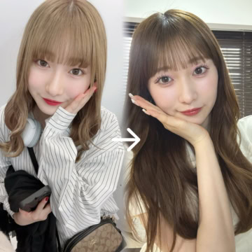 【美容医療】やって良かった・後悔したことは？二重埋没・ヒアル・ボトックスを本音レポ【sweet lovers】